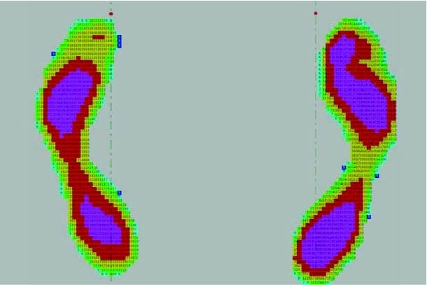 Imagen zonas de presión para las plantillas Ergodinámica, esquema de calor